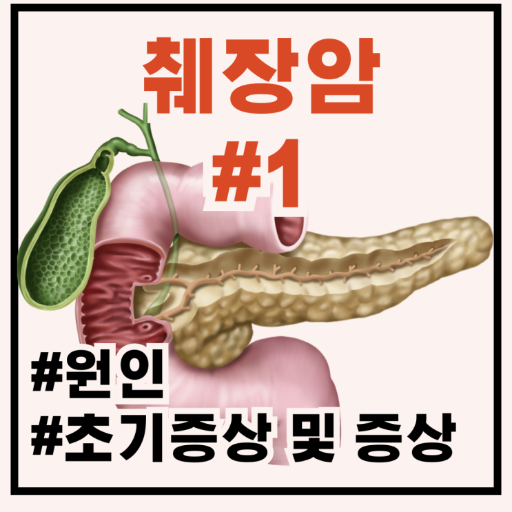 췌장암초기증상 및 원인, 초기진단 검사방법 : 네이버 블로그