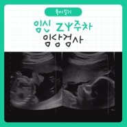 [육아일기] 임산부 24주차 임당검사!(feat.재검사대상..)
