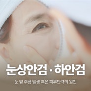인천 주안동 미추홀구 피부과 눈쳐짐 상안검, 눈 밑 지방 하안검 개선 방법은