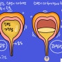 야간뇨 자다가 소변 못참는 성인