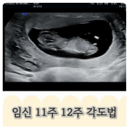임신 11주 12주 태아 성별 각도법 삼각점 아들?