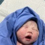 또복이 출산, 36주 5일 3.1kg, 제왕절개 /임당 산모