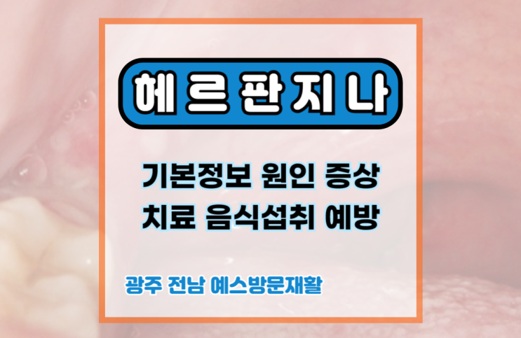 헤르판지나 헤르팡지나 (Herpangina) 포진성구협염, 수족구병 관계, 기본정보, 원인, 증상, 치료. : 네이버 블로그