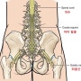 마미증후군馬尾症候群말총증후군 cauda equina syndrome 허리가 심하게 아프며 대소변이 줄줄 나와요 포항한의원 오천읍 허한의원