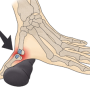 손바닥 부위별 통증 가운데 아픔 원인 개선 방법