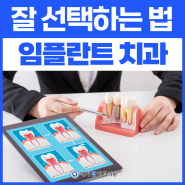 임플란트 치과 잘 선택 하는 법, 비산동 메가탑