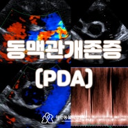 강아지 동맥관개존증 (PDA) 수술