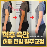 광주 봉선동 필라테스 _ 척추 측만, 어깨 전방 활주 교정