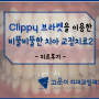 [제주 고운이 교정치과]Clippy 브라켓을 이용한 비뚤비뚤한 치아교정 치료증례2