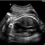 [임신 19-20주차] 입덧약 그거 어떻게 끊는건데/ 초음파 열달후에 입력/ 태동활발/ 임신선/ 일상