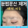 강남역 눈썹 문신제거비용 문신제거 후기