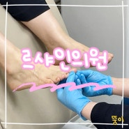강남 발톱무좀 치료 '르샤인 피부과의원' 8차