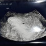 👶🏻임신일기] 4주차 임신피검사 + 초음파결과