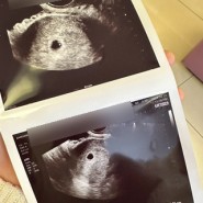 배란 22일 삼성미래여성병원 임신 5주 1일 아기집 난황 초음파 사진 확인 후 임신 확인서 발급 !