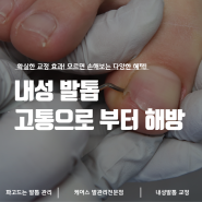 파고드는 발톱 관리(내성발톱)