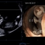 임신9주,12주차 6일 1차 기형아 검사, 12주 입체 초음파