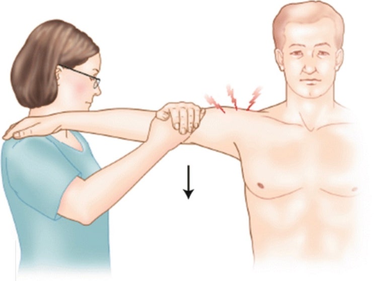 Feagin test 어깨 아래쪽 불안정성을 알아보는 휘긴검사에 대해 알아보자 : 네이버 블로그