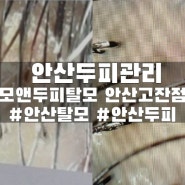 안산두피관리 <모앤두피탈모 안산고잔점>::유수분밸런싱 관리 추천