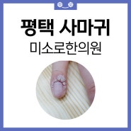 [미소로한의원] 평택사마귀 손으로 뜯지마세요