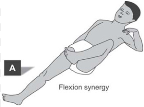 뇌졸중 환자의 공동운동패턴과 에너지 저장 및 방출의 고유한 인체 움직임 패턴 - GOATA MOVEMENT : 네이버 블로그