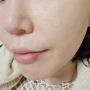 [미용] 내돈내산 스킨보톡스_스킨보톡스 효과, 스킨보톡스 통증 솔직후기 리뷰