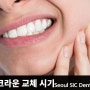 삼성역치과_seoul SIC Dental Clinic_내치아 크라운 교체 시기