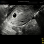 [임신] 두근두근 첫 초음파