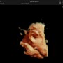 [임신 39주차] 이대서울병원 막달 태동검사 초음파 검사