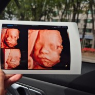 임신 27주차 공포의 임당검사 입체초음파 기록