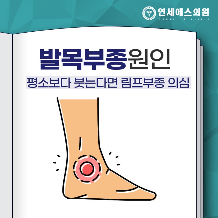 발목부종원인 평소보다 자꾸만 붓는다면 림프부종 의심 : 네이버 블로그