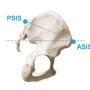 여성들에게 많은 골반 전방 경사(pelvic anterior tilt)와 요추 과전만(lumbar hyper lordosis)의 구조적인 원인 제거 운동~!