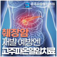 대전에서 췌장암 수술 후 암병원에서는 재발 위험 '이것'으로 관리