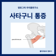 사타구니 통증 원인 치골근(두덩근) 위치 기능 및 스트레칭