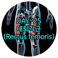 삼송피티 DAY-25 대퇴직근(Rectus femoris)-대퇴사두근군(Quadriceps femoris group) 화정재활