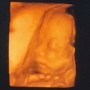 21주차 임신기록 정밀초음파로 아가 얼굴 보기