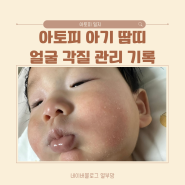 아토피 아기 땀띠 두드러기 관리 & 이유식 일지 기록