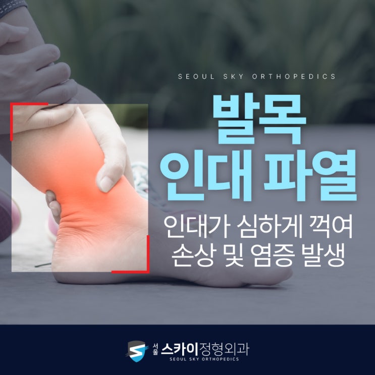 중계역 정형외과 발목인대파열 증상과 비수술 케어 방법은? : 네이버 블로그
