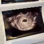 [임신일기-6주 3일] 0.3cm의 작은 생명...💝