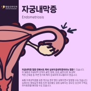 자궁내막증 장기 치료 및 수술, 관리에 대하여 (청담산부인과)