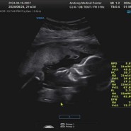 [임신기록 19주~23주] 드디어 느껴지는 태동
