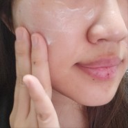 점빼기 관리 피부재생크림 추천
