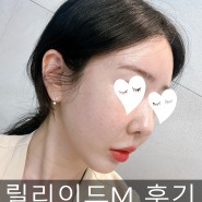 강남역피부과 릴리이드M 효과 후기(엠보,가격,부작용)