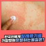 한국인에게 알레르기를 가장 많이 유발하는 물질은?