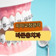 치아교정 올바른 관리를 위한 방법