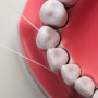 치실을 사용해야 하는 이유와 사용법에 대해