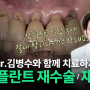 ✅ 심한 치경부 마모증과 임플란트 재수술 I 심한 치경부 마모증을 가진 환자의 임플란트 재수술 증례를 살펴보며 치료 과정과 방법을 알려드립니다