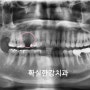 목포 임플란트 - 목포 확실한강치과의원.