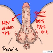 남자 HPV 백신 가다실 어떤거 맞아야 하나요