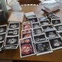 임신 19주차 6일 검진 - 서유럽 태교여행 하루 앞둔 검진