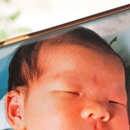 신생아 연어반 아기 붉은 반점 홍반 5살 경과
